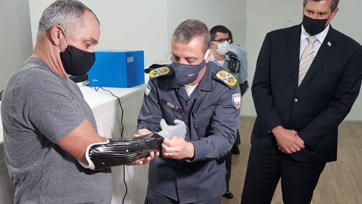 ASSOCIADO RECEBE MÃO BIÔNICA